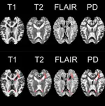 Front-end and back-end development for multiple sclerosis lesion segmentation (MulS) challenge